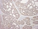 MDC1 Antibody in Immunohistochemistry (Paraffin) (IHC (P))
