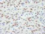 MDC1 Polyclonal Antibody