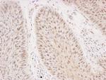 Rad50 Polyclonal Antibody