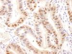 Rad6 Polyclonal Antibody