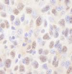 Rad6 Antibody in Immunohistochemistry (Paraffin) (IHC (P))