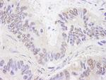 BTF Antibody in Immunohistochemistry (Paraffin) (IHC (P))