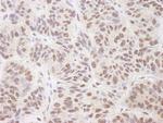 BTF Polyclonal Antibody