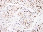 Matrin 3 Antibody in Immunohistochemistry (Paraffin) (IHC (P))