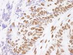 Matrin 3 Polyclonal Antibody