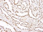 Nucleolin/NCL Polyclonal Antibody