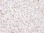 Nucleolin/NCL Antibody in Immunohistochemistry (Paraffin) (IHC (P))