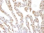 VCP Polyclonal Antibody