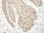 EWS Antibody in Immunohistochemistry (Paraffin) (IHC (P))