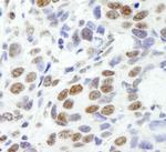 EWS Polyclonal Antibody