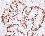 hnRNP-H Polyclonal Antibody