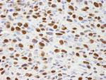 hnRNP-H Antibody in Immunohistochemistry (Paraffin) (IHC (P))