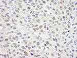 CCAR1 Antibody in Immunohistochemistry (Paraffin) (IHC (P))