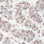 PRKRIR Polyclonal Antibody