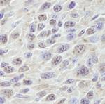 PRKRIR Antibody in Immunohistochemistry (Paraffin) (IHC (P))