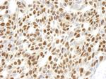 RPL26 Antibody in Immunohistochemistry (Paraffin) (IHC (P))
