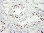 ZWINT-1 Antibody in Immunohistochemistry (Paraffin) (IHC (P))