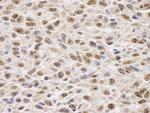 GAPDH Antibody in Immunohistochemistry (Paraffin) (IHC (P))