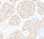 TPR Antibody in Immunohistochemistry (Paraffin) (IHC (P))