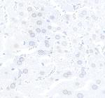 TPR Antibody in Immunohistochemistry (Paraffin) (IHC (P))