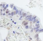 RNF20 Polyclonal Antibody