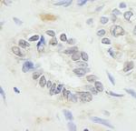 RNF20 Antibody in Immunohistochemistry (Paraffin) (IHC (P))