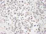 BAAT1 Antibody in Immunohistochemistry (Paraffin) (IHC (P))