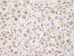 BAAT1 Antibody in Immunohistochemistry (Paraffin) (IHC (P))