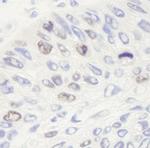 Topo II Alpha Antibody in Immunohistochemistry (Paraffin) (IHC (P))