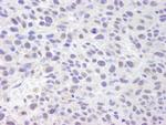 ASH2 Polyclonal Antibody