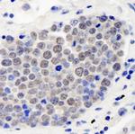 CSN3 Antibody in Immunohistochemistry (Paraffin) (IHC (P))