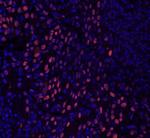 GTF2I/TFII-I Antibody in Immunohistochemistry (Paraffin) (IHC (P))