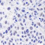 GTF2I/TFII-I Antibody in Immunohistochemistry (Paraffin) (IHC (P))
