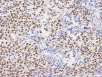 GTF2I/TFII-I Antibody in Immunohistochemistry (Paraffin) (IHC (P))