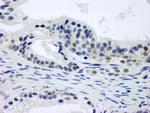CSN1 Polyclonal Antibody