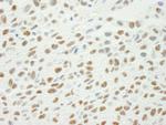 Phospho-XRCC1 (Ser461) Antibody in Immunohistochemistry (Paraffin) (IHC (P))