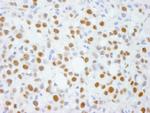 ADNP Antibody in Immunohistochemistry (Paraffin) (IHC (P))