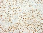 MSH6 Antibody in Immunohistochemistry (Paraffin) (IHC (P))