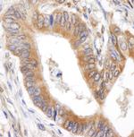 BID Antibody in Immunohistochemistry (Paraffin) (IHC (P))