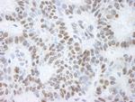 BHC110/LSD1 Polyclonal Antibody