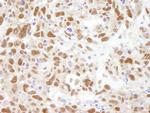 Bub3 Antibody in Immunohistochemistry (Paraffin) (IHC (P))