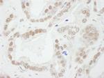 Bub3 Polyclonal Antibody