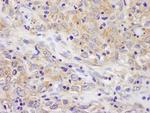 BIRC6/Apollon Polyclonal Antibody