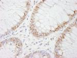 CDX2 Antibody in Immunohistochemistry (Paraffin) (IHC (P))