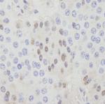 CDT1 Polyclonal Antibody