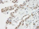 BAF57/SMARCE1 Antibody in Immunohistochemistry (Paraffin) (IHC (P))