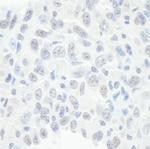 BAF57/SMARCE1 Polyclonal Antibody