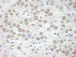 DDX17 Polyclonal Antibody