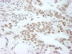 DDX1 Polyclonal Antibody