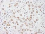 DDX1 Antibody in Immunohistochemistry (Paraffin) (IHC (P))
